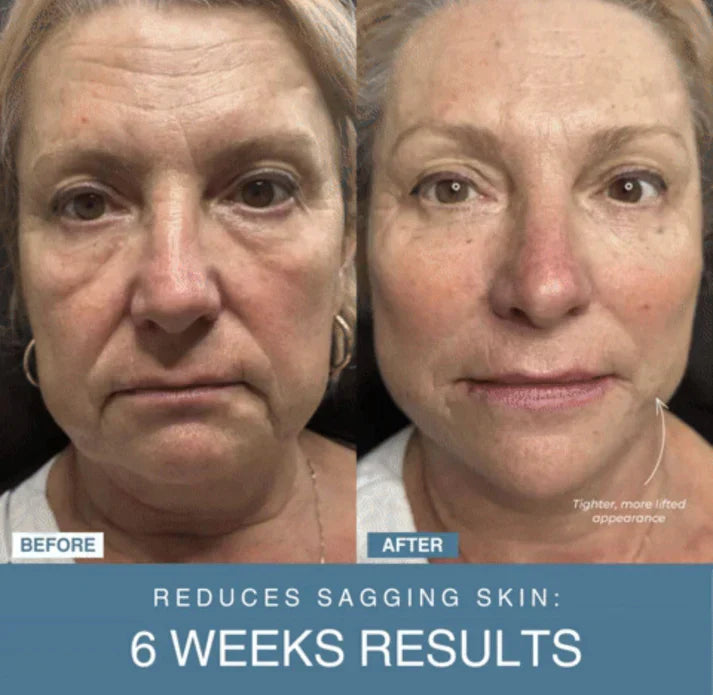 Uswah™ 7-in-1 LED Anti-Aging/Wrinkle Apparatus